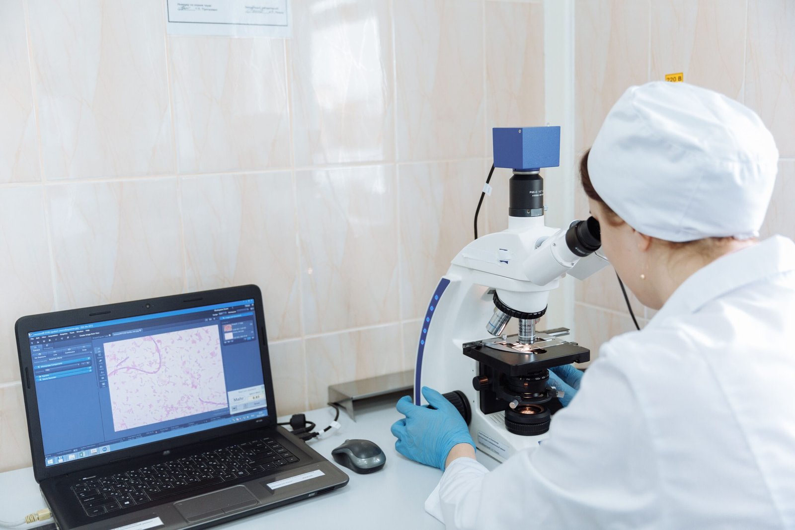 A professional medical journalism photograph showcasing a high-tech laboratory microscope analyzing cellular cardiac tissue samples representing bacteria from gum disease heart valves links
