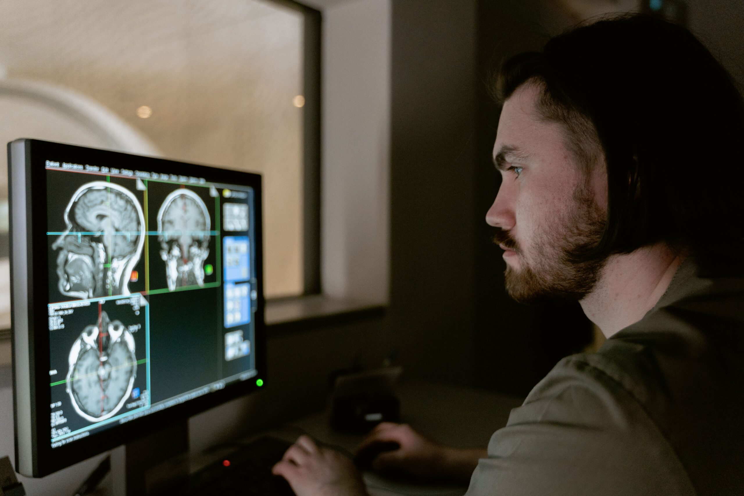 A professional medical journalism photograph showcasing a high-resolution digital human brain scan on a clinical monitor inside a modern neurology laboratory